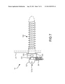 Orthodontic System diagram and image