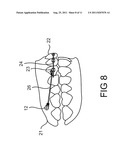 Orthodontic System diagram and image