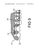 Orthodontic System diagram and image