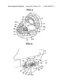 OCCLUSION CORRECTION IMPROVEMENT INSTRUMENT AND CORRECTION IMPROVEMENT     METHOD USING THE INSTRUMENT diagram and image