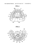 OCCLUSION CORRECTION IMPROVEMENT INSTRUMENT AND CORRECTION IMPROVEMENT     METHOD USING THE INSTRUMENT diagram and image