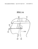 OCCLUSION CORRECTION IMPROVEMENT INSTRUMENT AND CORRECTION IMPROVEMENT     METHOD USING THE INSTRUMENT diagram and image