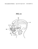 OCCLUSION CORRECTION IMPROVEMENT INSTRUMENT AND CORRECTION IMPROVEMENT     METHOD USING THE INSTRUMENT diagram and image