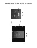 ULTRASOUND PHANTOM MODELS, MATERIALS, AND METHODS diagram and image