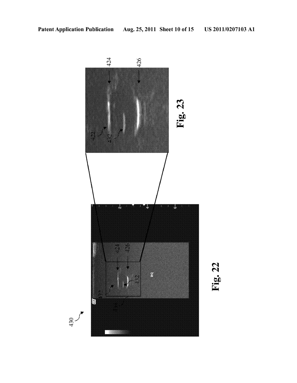 ULTRASOUND PHANTOM MODELS, MATERIALS, AND METHODS - diagram, schematic, and image 11