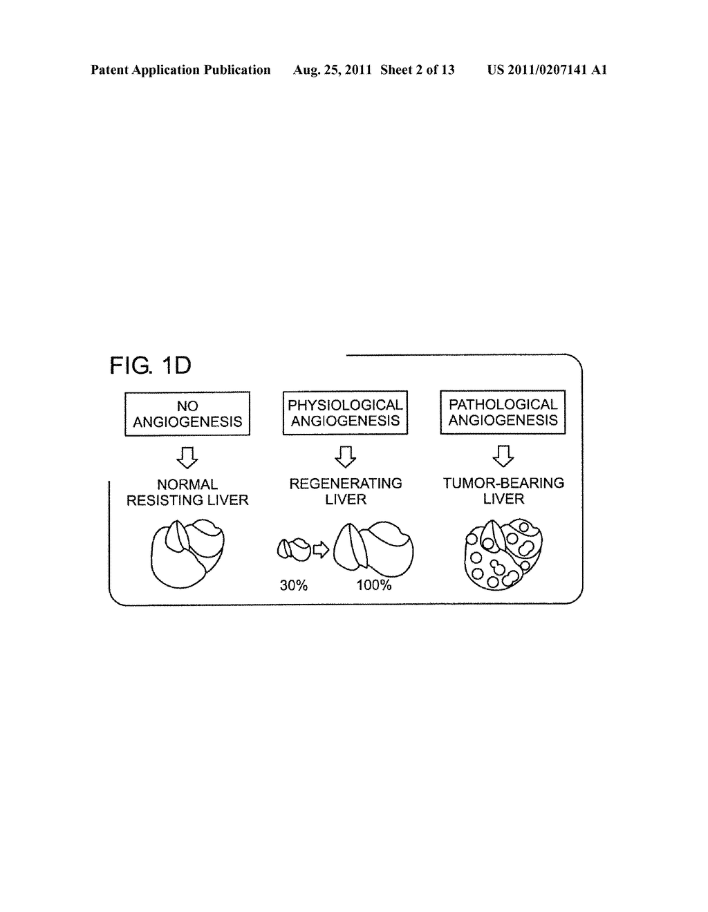 DIFFERENTIAL GENE EXPRESSION IN PHYSIOLOGICAL AND PATHOLOGICAL     ANGIOGENESIS - diagram, schematic, and image 03