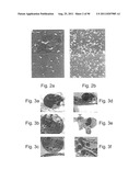 PROMOTERS EXHIBITING ENDOTHELIAL CELL SPECIFICITY AND METHODS OF USING     SAME FOR REGULATION OF ANGIOGENESIS diagram and image