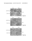 PROMOTERS EXHIBITING ENDOTHELIAL CELL SPECIFICITY AND METHODS OF USING     SAME FOR REGULATION OF ANGIOGENESIS diagram and image