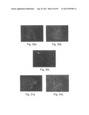 PROMOTERS EXHIBITING ENDOTHELIAL CELL SPECIFICITY AND METHODS OF USING     SAME FOR REGULATION OF ANGIOGENESIS diagram and image