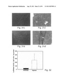 PROMOTERS EXHIBITING ENDOTHELIAL CELL SPECIFICITY AND METHODS OF USING     SAME FOR REGULATION OF ANGIOGENESIS diagram and image