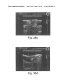 PROMOTERS EXHIBITING ENDOTHELIAL CELL SPECIFICITY AND METHODS OF USING     SAME FOR REGULATION OF ANGIOGENESIS diagram and image