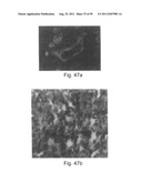 PROMOTERS EXHIBITING ENDOTHELIAL CELL SPECIFICITY AND METHODS OF USING     SAME FOR REGULATION OF ANGIOGENESIS diagram and image