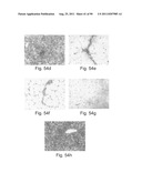 PROMOTERS EXHIBITING ENDOTHELIAL CELL SPECIFICITY AND METHODS OF USING     SAME FOR REGULATION OF ANGIOGENESIS diagram and image