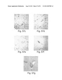 PROMOTERS EXHIBITING ENDOTHELIAL CELL SPECIFICITY AND METHODS OF USING     SAME FOR REGULATION OF ANGIOGENESIS diagram and image