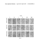 PROMOTERS EXHIBITING ENDOTHELIAL CELL SPECIFICITY AND METHODS OF USING     SAME FOR REGULATION OF ANGIOGENESIS diagram and image