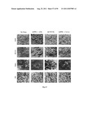 PROMOTERS EXHIBITING ENDOTHELIAL CELL SPECIFICITY AND METHODS OF USING     SAME FOR REGULATION OF ANGIOGENESIS diagram and image