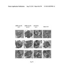 PROMOTERS EXHIBITING ENDOTHELIAL CELL SPECIFICITY AND METHODS OF USING     SAME FOR REGULATION OF ANGIOGENESIS diagram and image