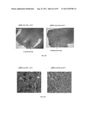 PROMOTERS EXHIBITING ENDOTHELIAL CELL SPECIFICITY AND METHODS OF USING     SAME FOR REGULATION OF ANGIOGENESIS diagram and image