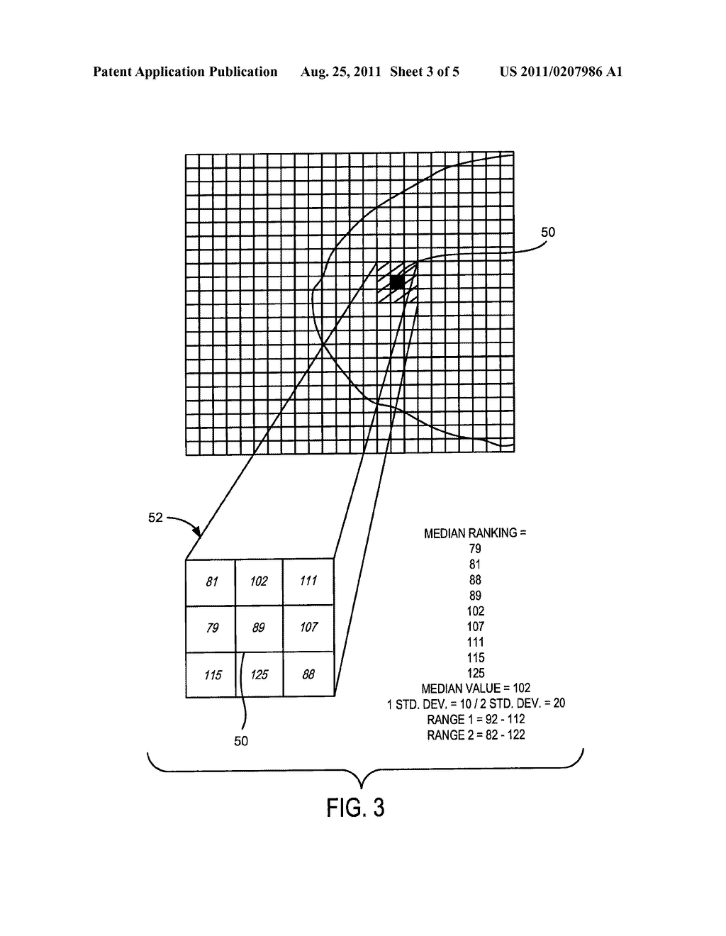 SYSTEM AND METHOD FOR RADIATION DOSE REDUCTION IN MOLECULAR BREAST IMAGING - diagram, schematic, and image 04