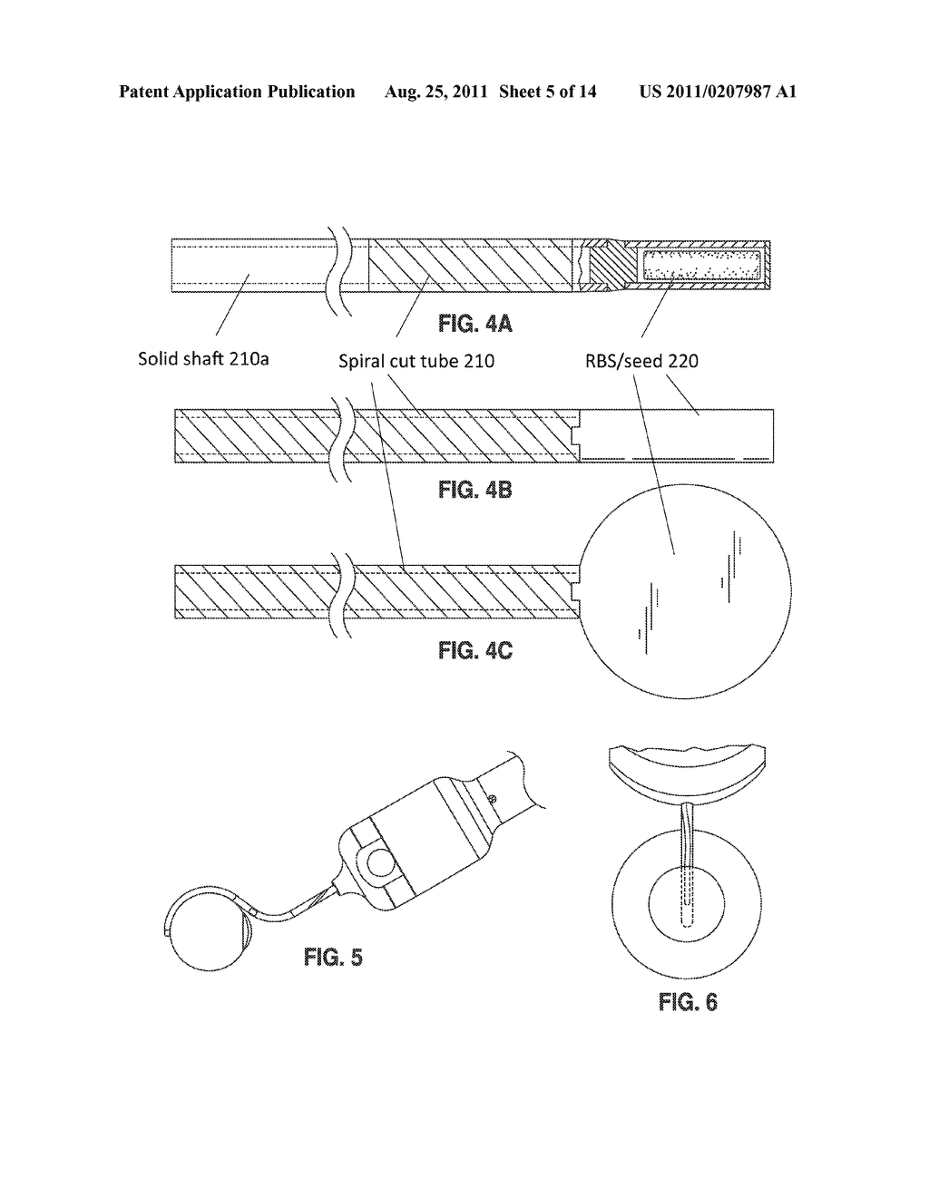 Methods And Devices For Delivering Appropriate Minimally-Invasive     Extraocular Radiation - diagram, schematic, and image 06