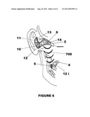 Methods and Apparatus for Aligning Antennas of Low-Powered Intra - and     Extra - Oral Electronic Wireless Devices diagram and image