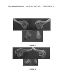 METHOD FOR ARTIFICIAL INSEMINATION OF COWS diagram and image