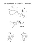 Methods and Devices for Treating Morbid Obesity Using Hydrogel diagram and image