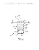 Methods and Devices for Treating Morbid Obesity Using Hydrogel diagram and image