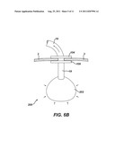 Methods and Devices for Treating Morbid Obesity Using Hydrogel diagram and image