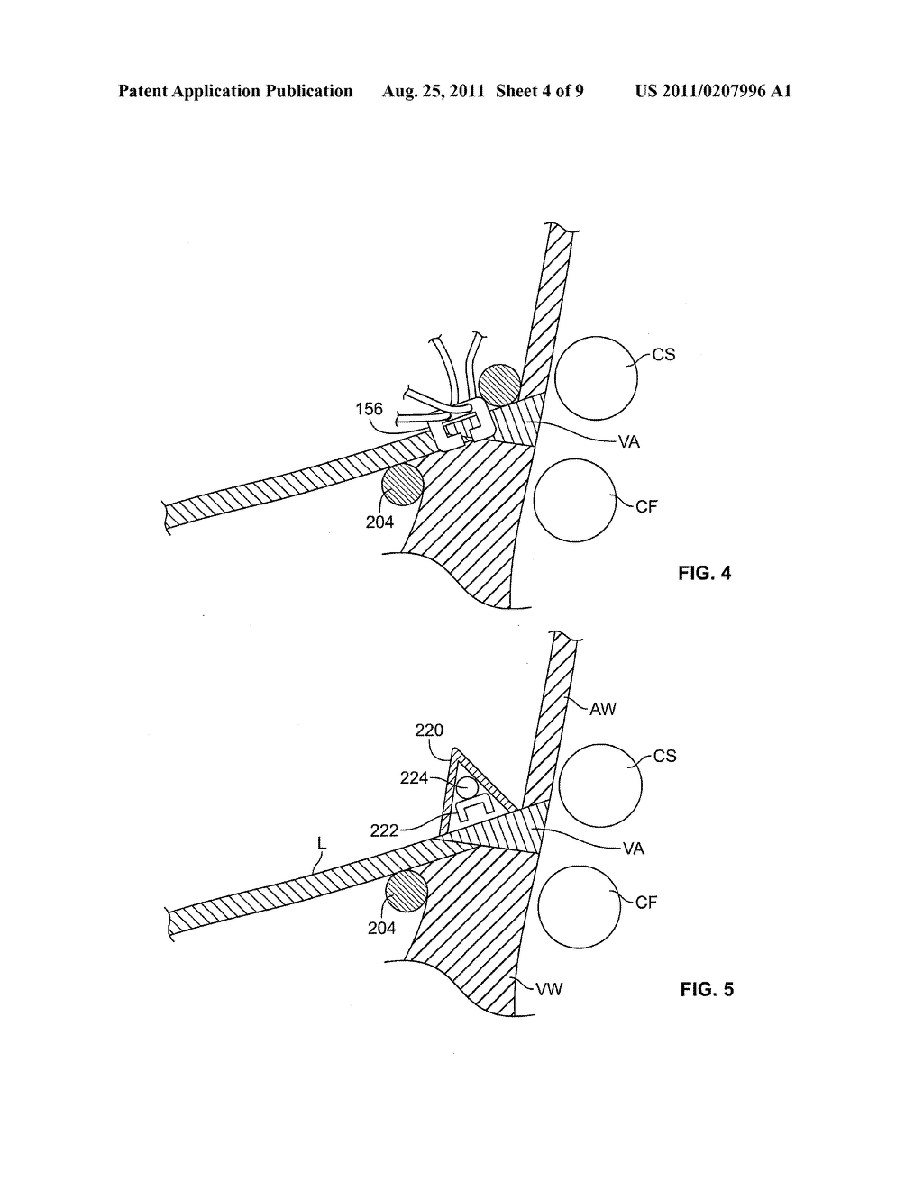 DEVICES AND METHODS FOR CARDIAC ANNULUS STABILIZATION AND TREATMENT - diagram, schematic, and image 05