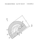 DEVICES AND METHODS FOR CARDIAC ANNULUS STABILIZATION AND TREATMENT diagram and image