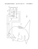 METHOD AND APPARATUS FOR BRAIN DAMAGE DETECTION diagram and image