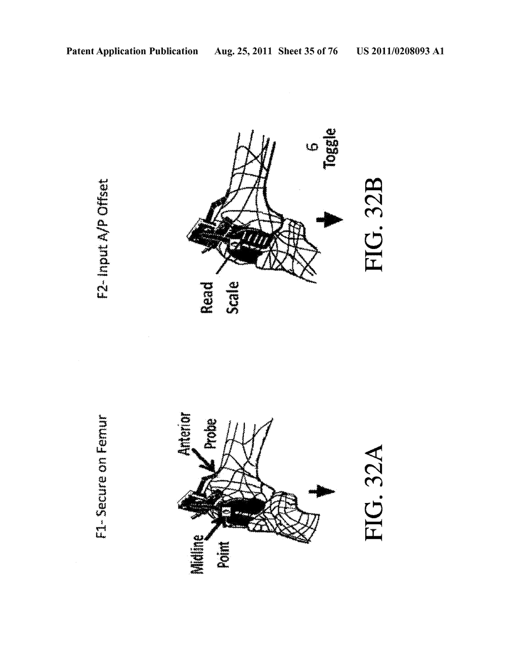 SYSTEMS AND METHODS FOR JOINT REPLACEMENT - diagram, schematic, and image 36