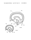 ULTRASOUND NEUROMODULATION OF THE RETICULAR ACTIVATING SYSTEM diagram and image