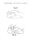 Electrokinetic Delivery System for Self-Administration of Medicaments and     Methods Therefor diagram and image