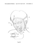 Electrokinetic Delivery System for Self-Administration of Medicaments and     Methods Therefor diagram and image