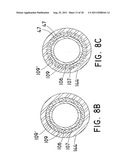 Melt-Bonded Joint for Joining Sheaths Used in Medical Devices, and Methods     of Forming the Melt-Bonded Joint diagram and image