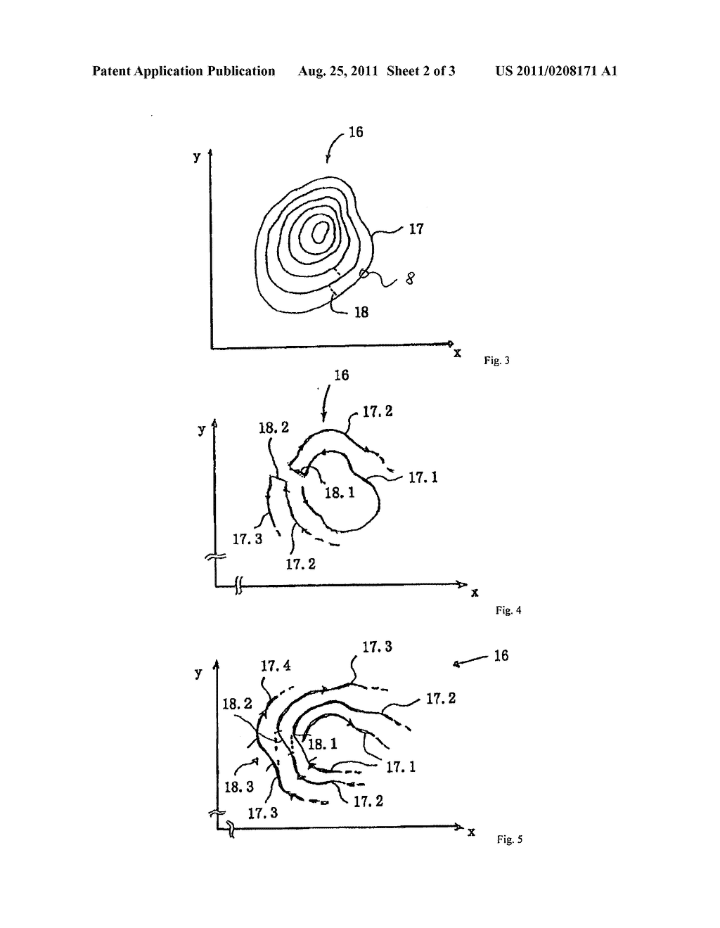 METHOD AND DEVICE FOR FORMING CUT SURFACES IN A TRANSPARENT MATERIAL - diagram, schematic, and image 03