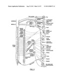 Methods for Treating sleep apnea via renal Denervation diagram and image