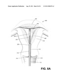 SYSTEMS AND METHODS FOR CERVICAL SEAL diagram and image