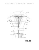 SYSTEMS AND METHODS FOR CERVICAL SEAL diagram and image