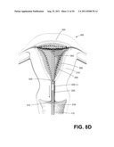 SYSTEMS AND METHODS FOR CERVICAL SEAL diagram and image