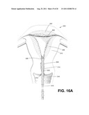 SYSTEMS AND METHODS FOR CERVICAL SEAL diagram and image