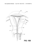 SYSTEMS AND METHODS FOR CERVICAL SEAL diagram and image