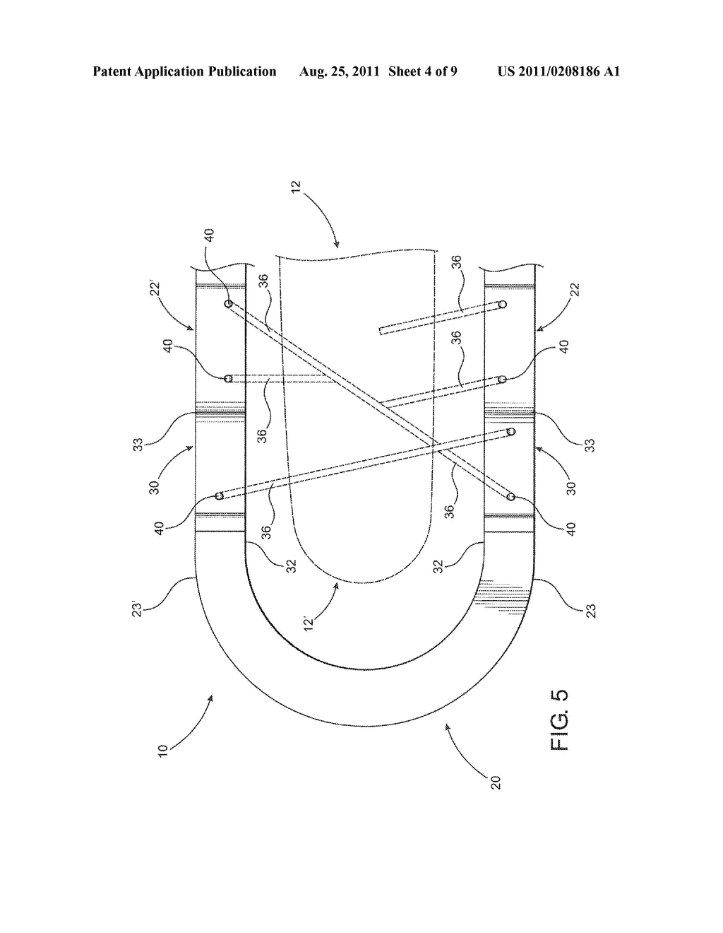 EXTERNAL FIXATOR ASSEMBLY - diagram, schematic, and image 05