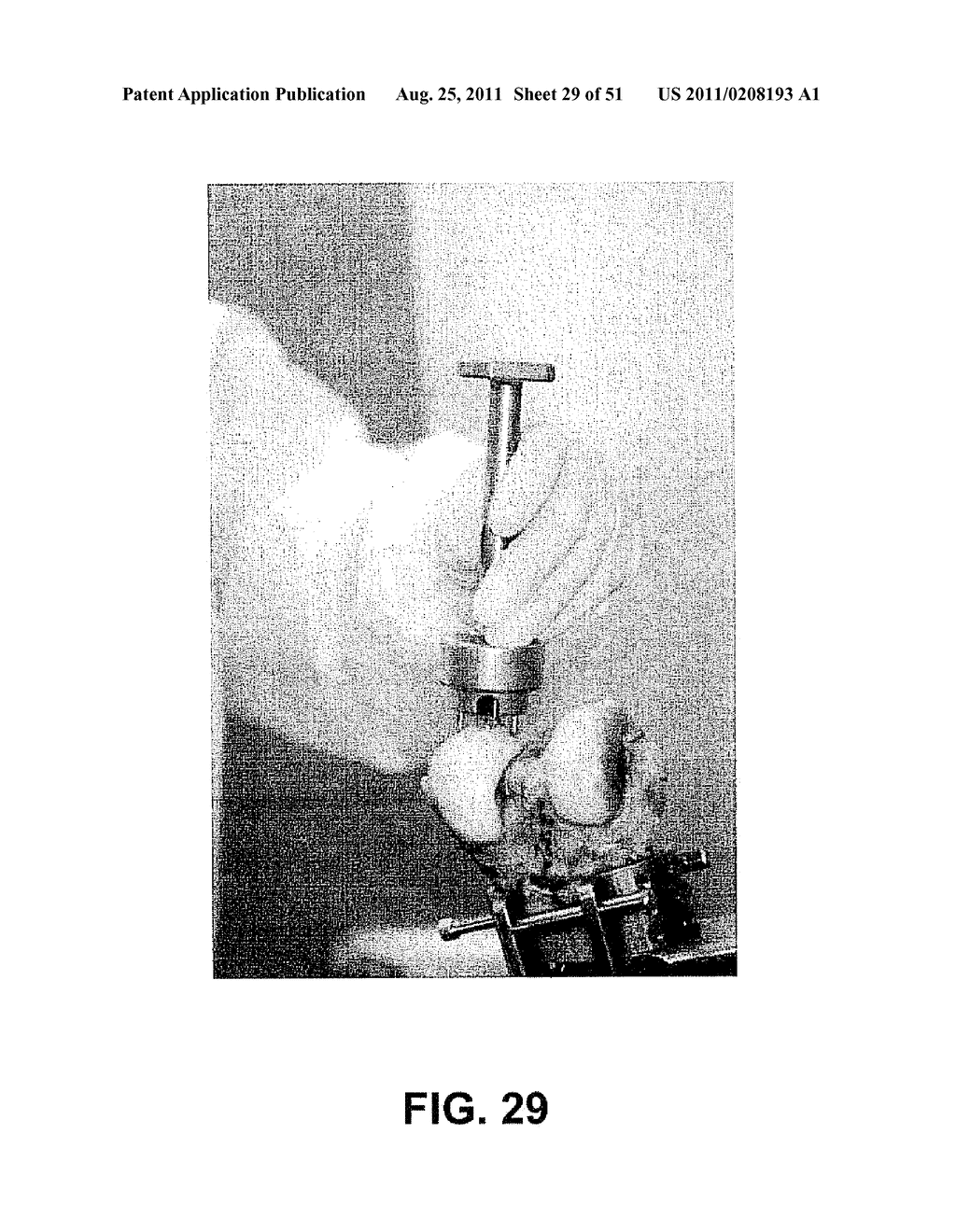 System and Method of Harvesting Osteochondral Plugs - diagram, schematic, and image 30