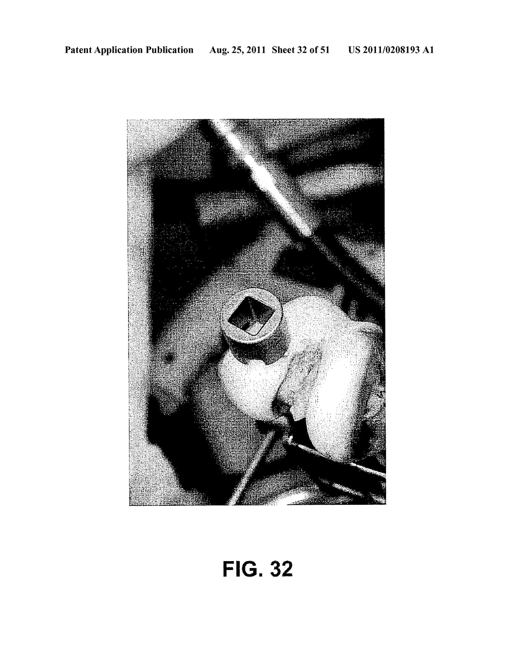 System and Method of Harvesting Osteochondral Plugs - diagram, schematic, and image 33