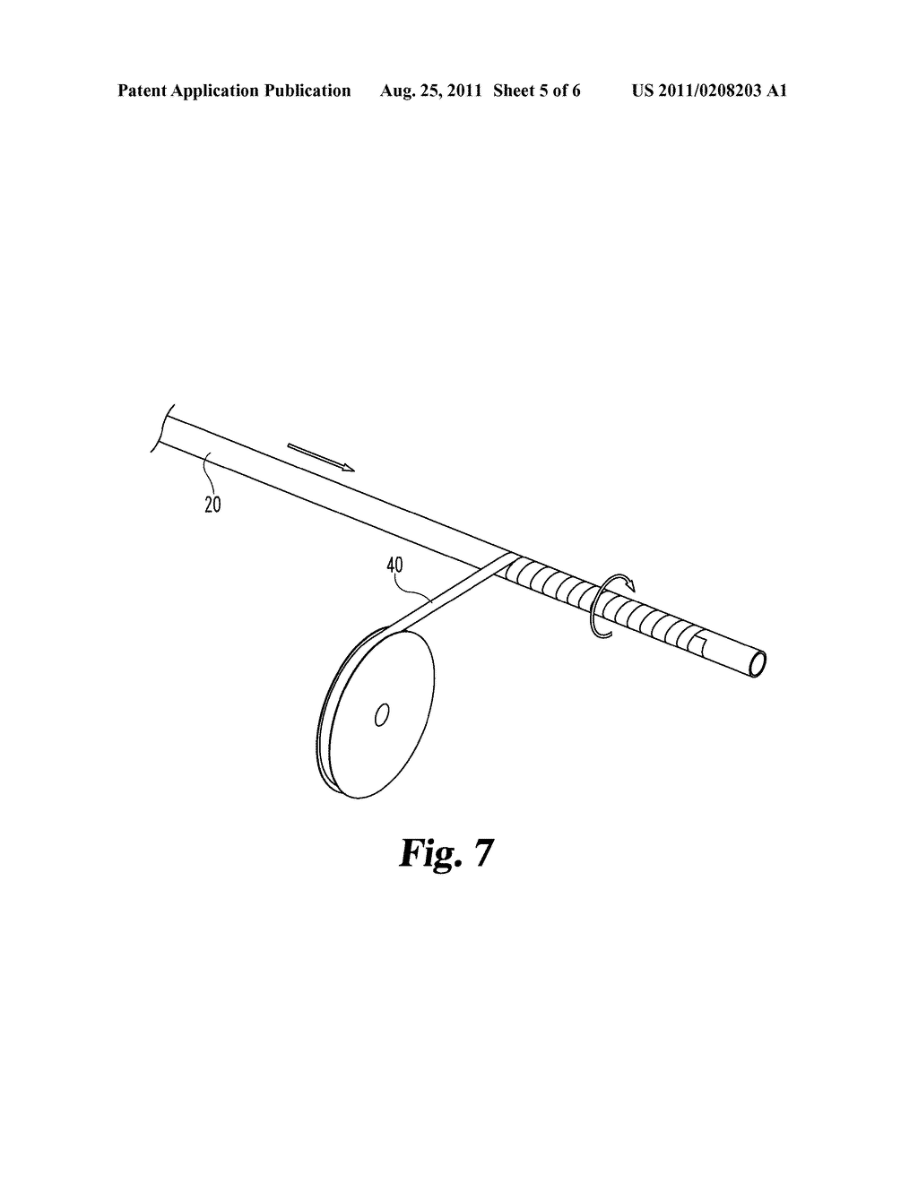 PRESSURE SENSING VERTEBROPLASTY EXTENSION TUBE - diagram, schematic, and image 06