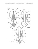 PROSTHESIS AND METHOD FOR SURGICAL TREATMENT OF INGUINAL HERNIAS diagram and image