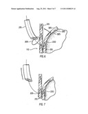 METHOD AND APPARATUS FOR ENDOSCOPIC REPAIR OF THE LOWER ESOPHAGEAL     SPHINCTER diagram and image